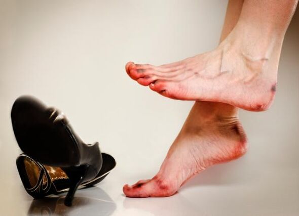 O desenvolvemento de fungos nas unhas dos pés pode ser causado por zapatos axustados